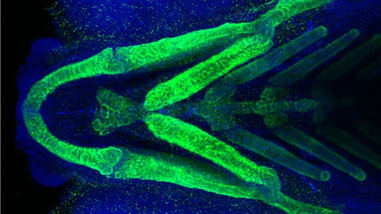 CRISPR Hunts Down Cause of Rare Medical Condition