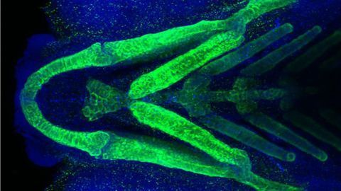 CRISPR Hunts Down Cause of Rare Medical Condition