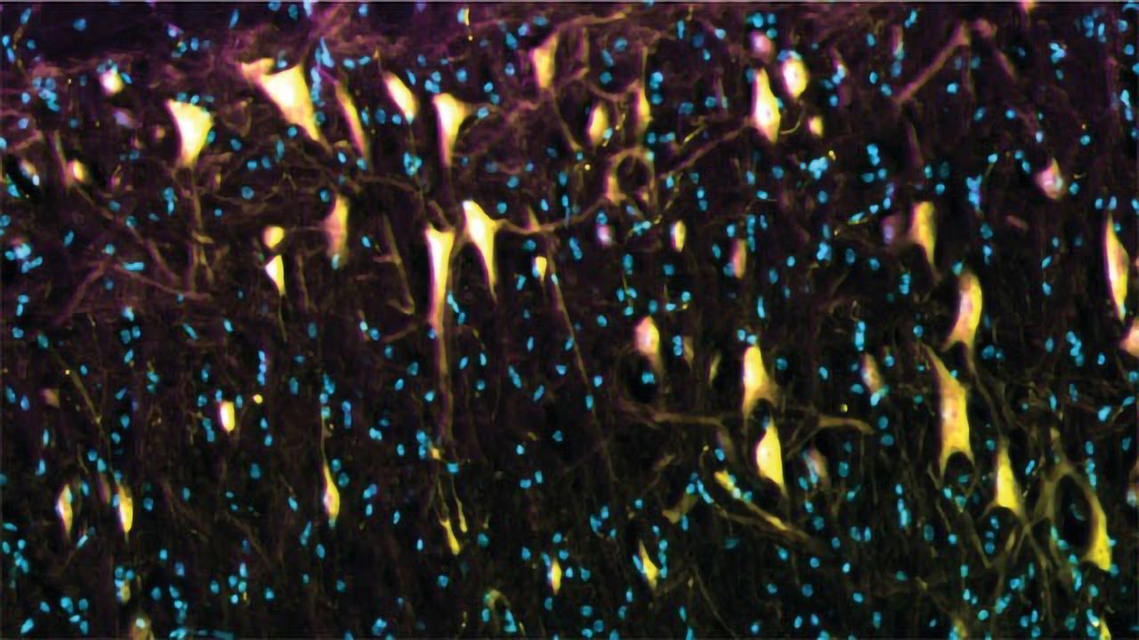 Peptide Treatment Relieves Chronic Pain in Mouse Model
