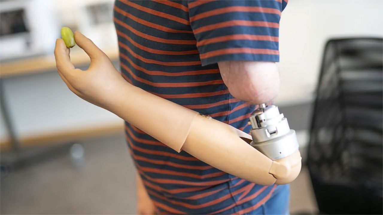 What's Everyday Life Like With a Mind-controlled Prosthetic Arm?
