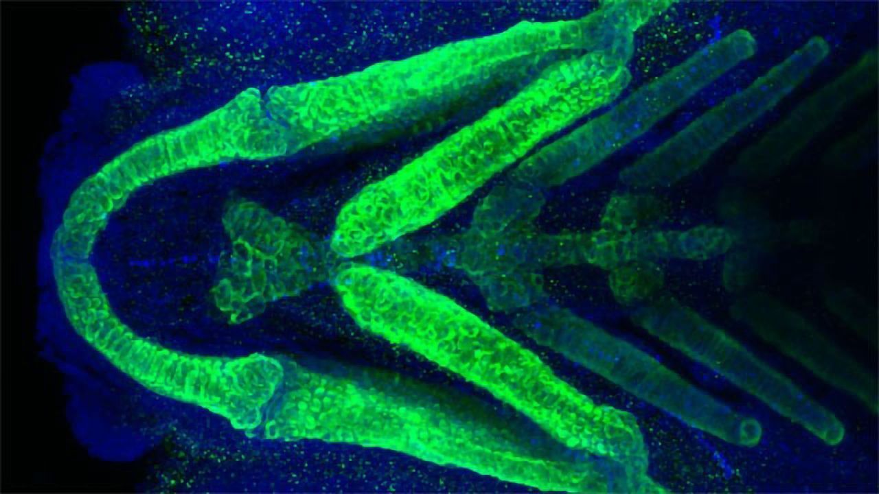 Investigating Craniofacial Development in Zebrafish
