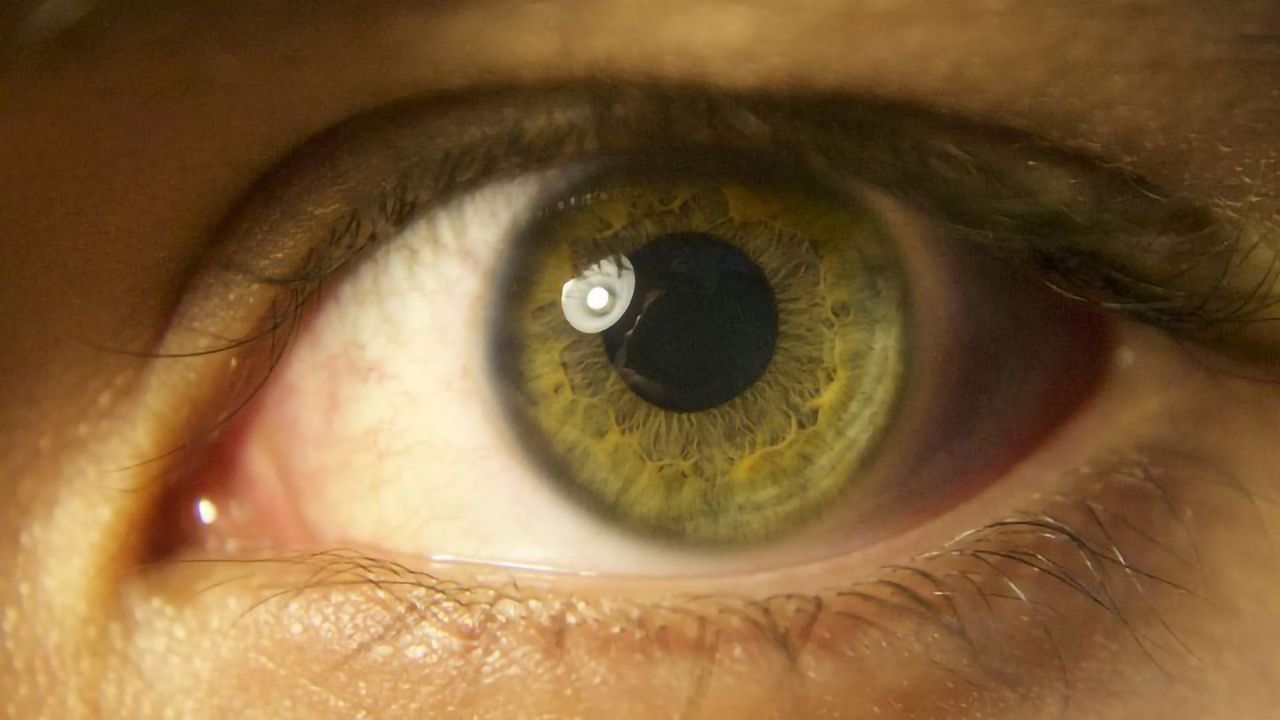 Subset of Retinal Neurons Communicates Differently From the Rest of the Eye
