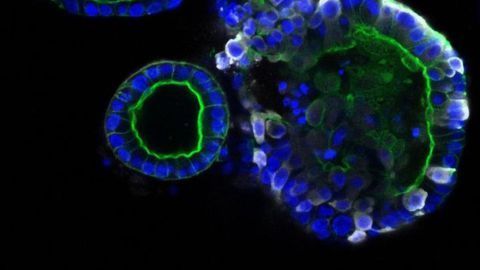 SARS-CoV-2 Infects Cells of the Intestine