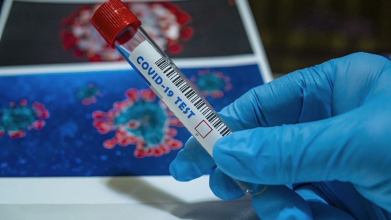 The Need for Broader Testing of COVID-19 Patients