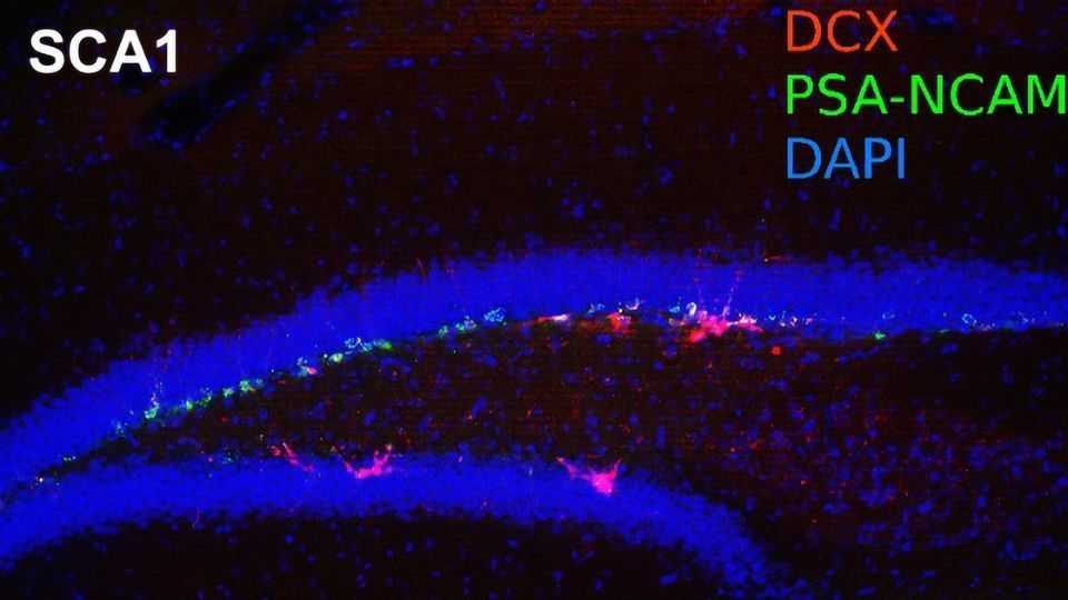 Why Does a Disease of the Cerebellum Cause Mental Health Disorders? An Explanation May Lie in the Hippocampus content piece image