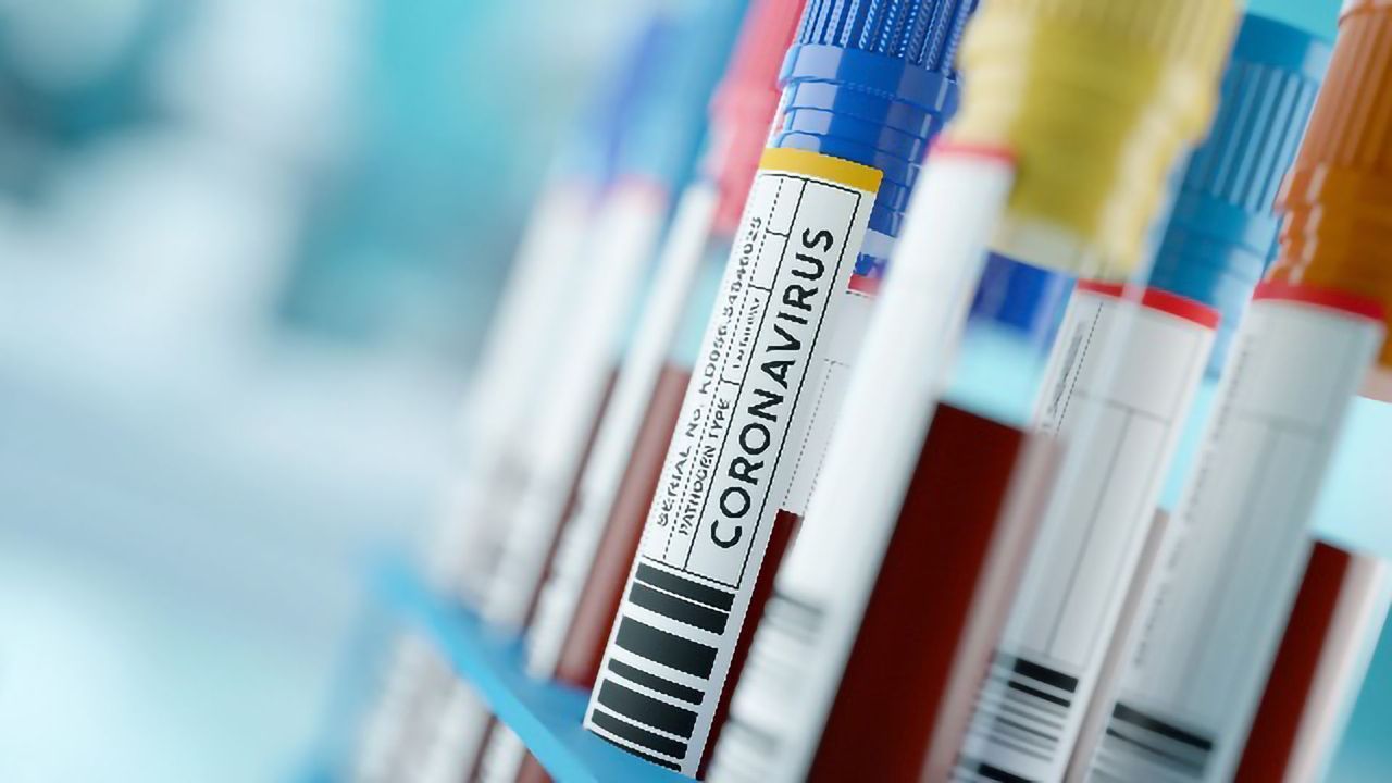 More Sensitive COVID-19 Testing Using Droplet Digital PCR