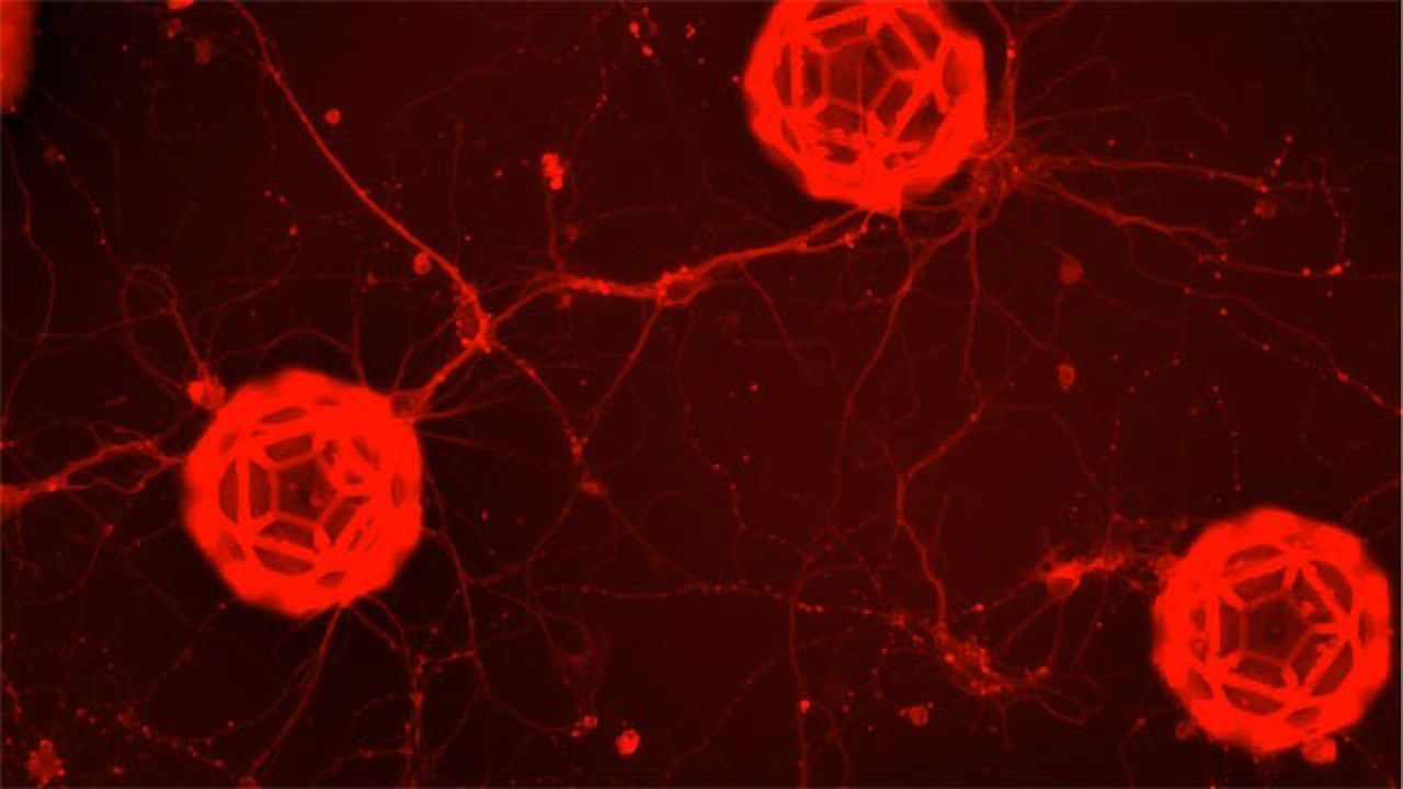 Neural Net
