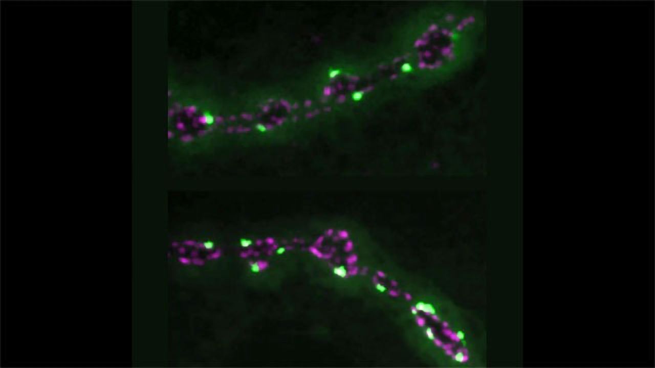 A "Volume Dial" Can Turn Neuronal Communication Up or Down