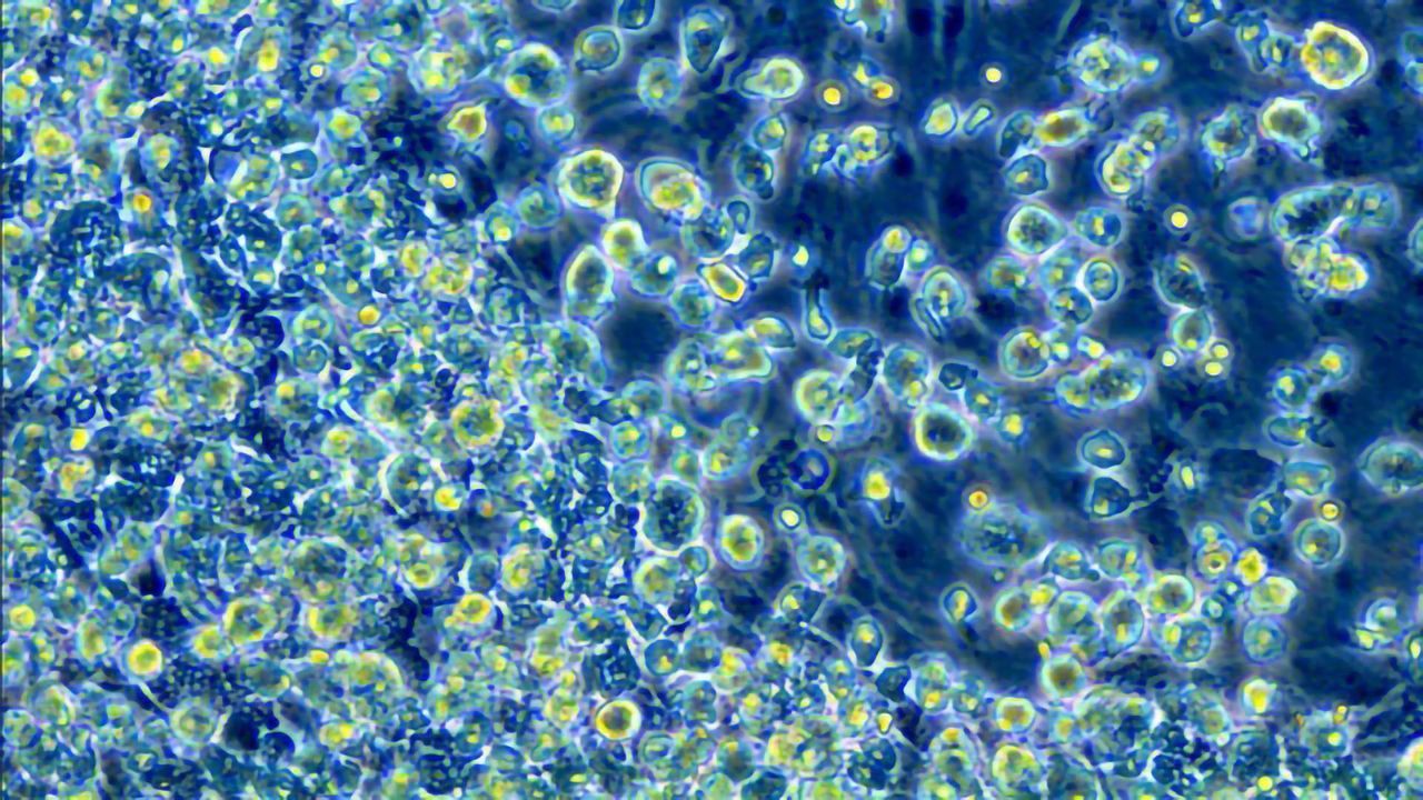 Computational Techniques Separates Out Single-cell Data From Multiple People