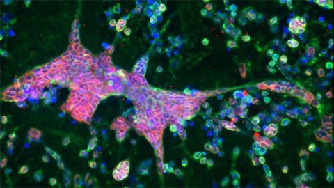 Brain-like Tissue Model Links Alzheimer's to Herpes Virus