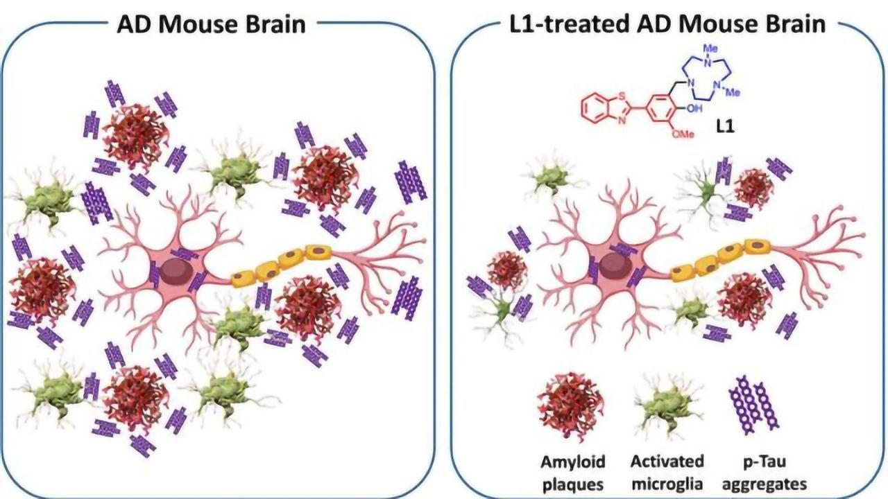 Molecule Reduces Multiple Pathologies Associated With Alzheimer's Disease