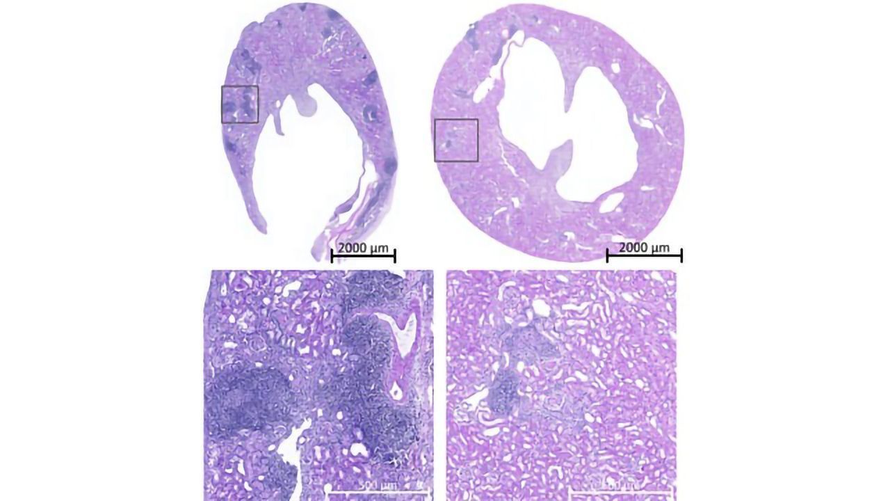 Immune System Discovery Could Reduce Organ Rejection