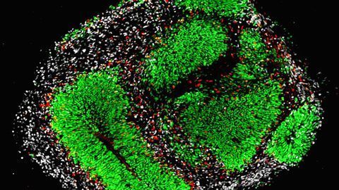 Lipid Metabolism Regulates Lifelong Activity of Brain Stem Cells