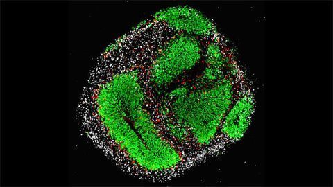 Cerebral Organoid