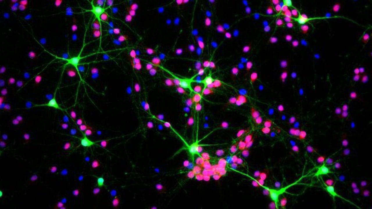 This Gene Is a Molecular "Knob" That Fine-tunes Our Cortex's Electrical Activity