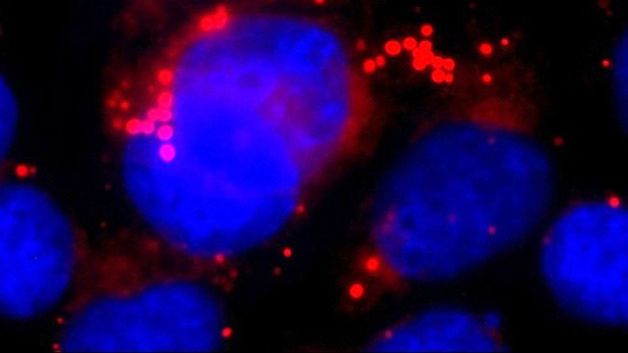 The "Protein Shredder" That Regulates Fat Metabolism in the Brain