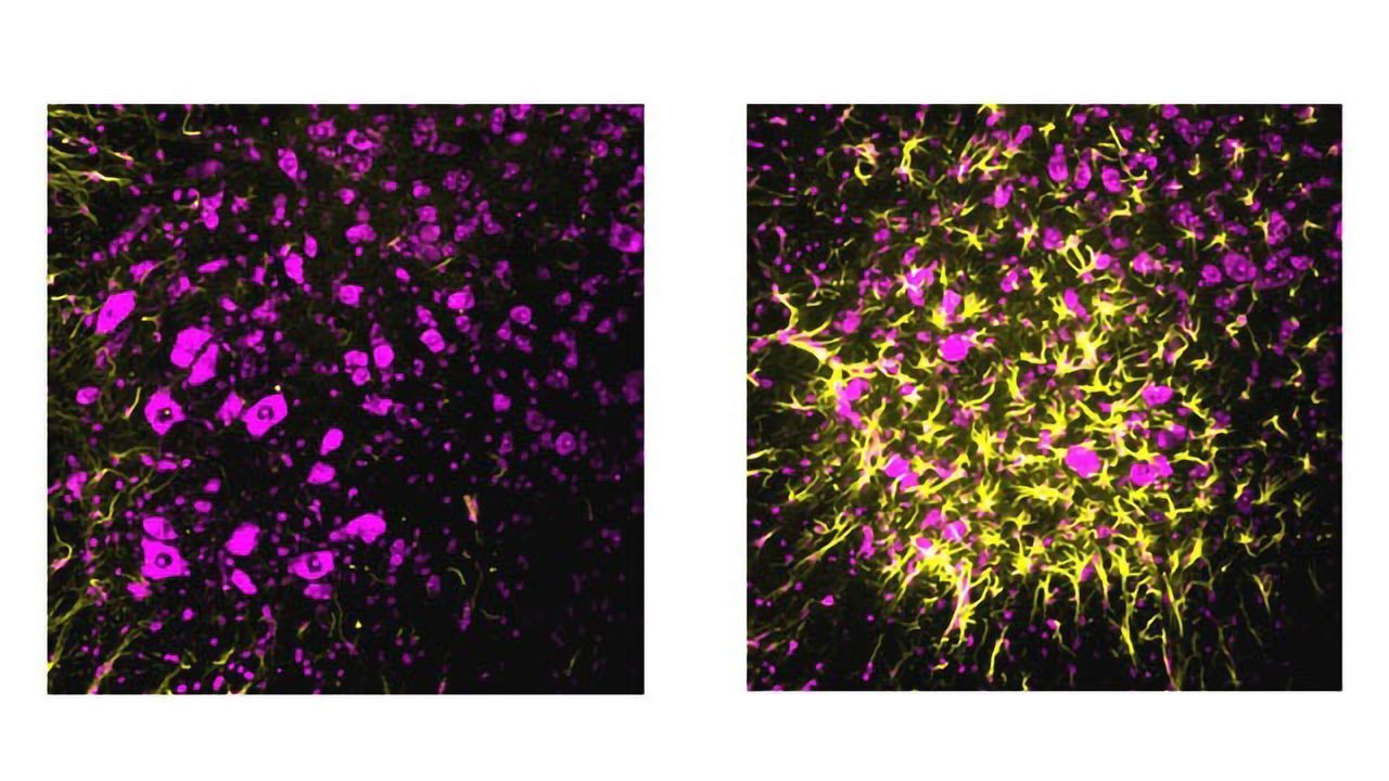 Synaptic Safety Mechanism Boosts Resilience to ALS in Mice