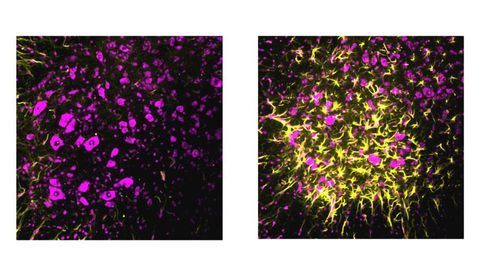 Synaptic Safety Mechanism Boosts Resilience to ALS in Mice
