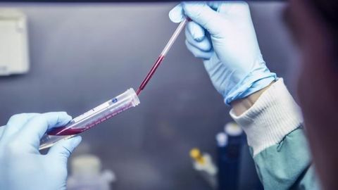 A Potential New Tool for Controlling Infections