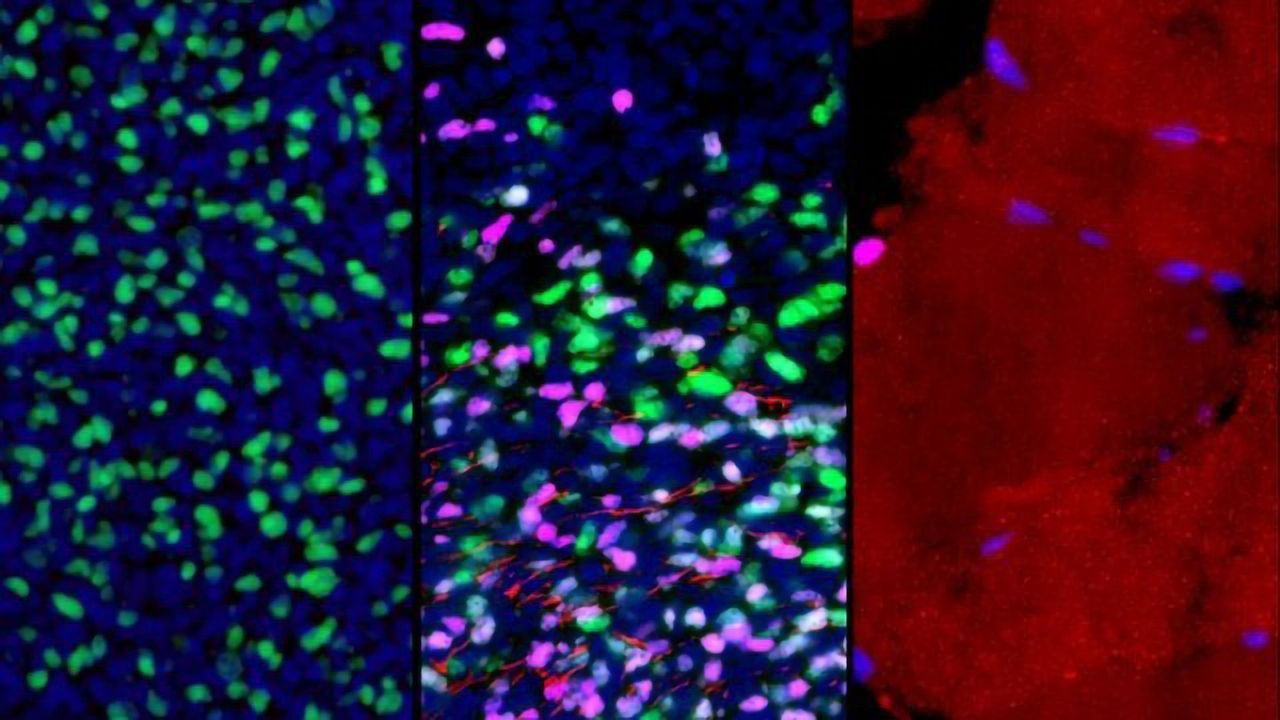 First Roadmap of Human Skeletal Muscle Development Created