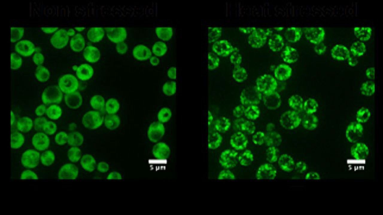 Who Takes the Temperature in Our Cells?