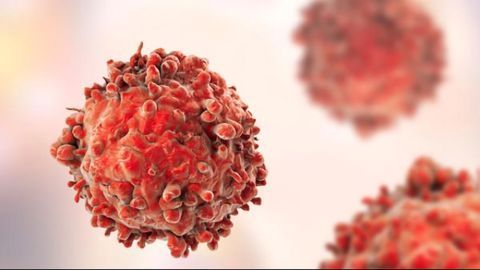 Saliva Test Detects Hidden Throat Cancer