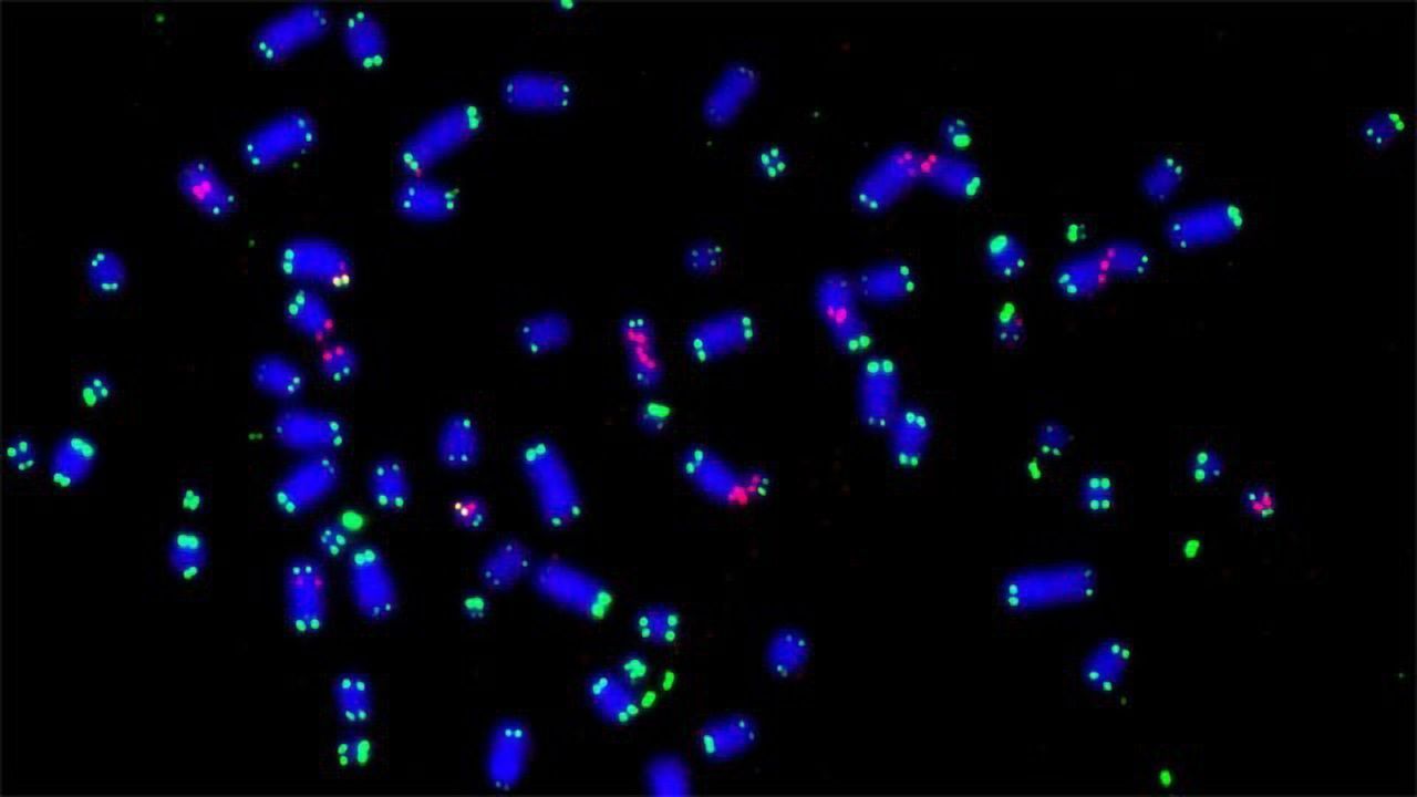 Protein Helps Cancer Cells Stay Alive and Thrive