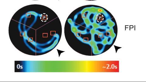 New Study Shows How Memory Function Could Be Preserved After Brain Injury