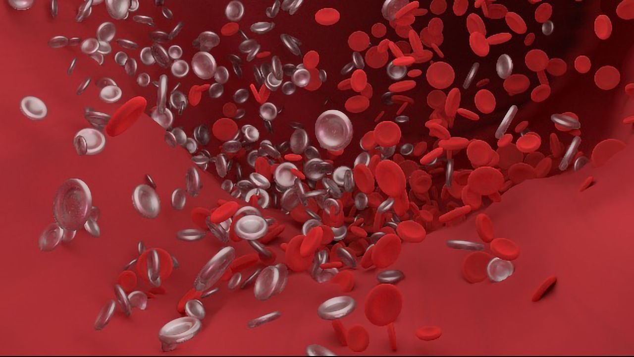 New Tool Helps Distinguish the Cause of Blood Clots