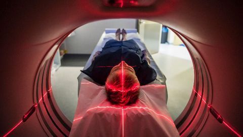 Early Alzheimer's Damage Revealed by New Imaging Technique