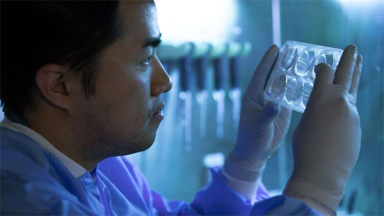Parkinson's Patient's Skin Cells Reprogrammed To Replace Lost Brain Cells