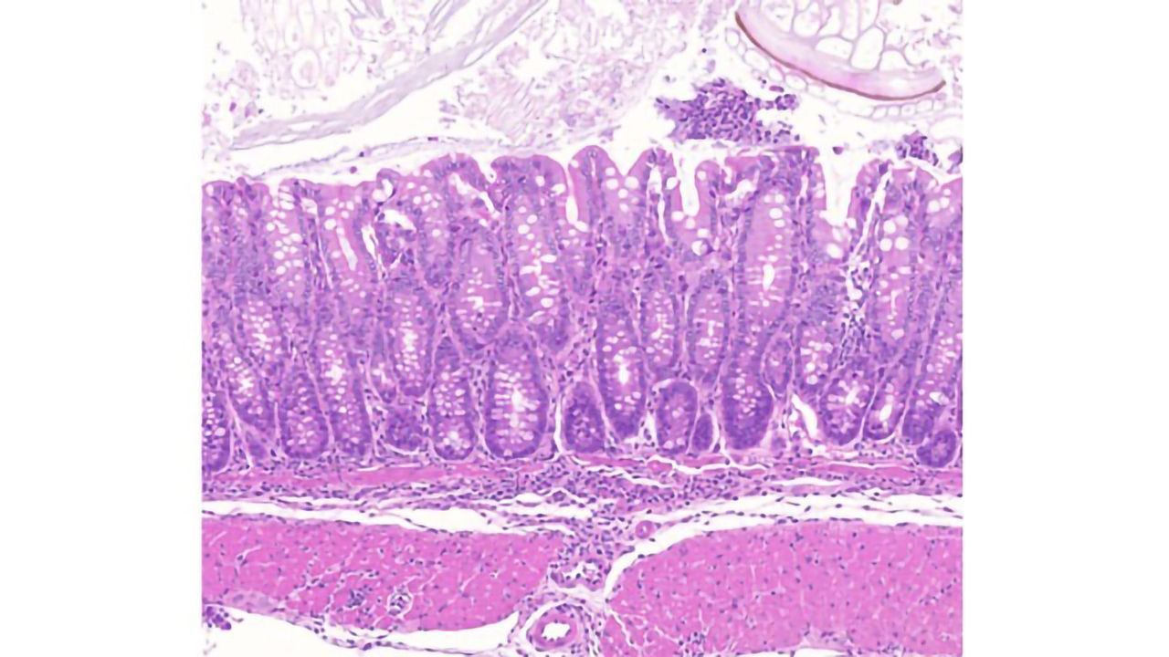 How "Dark Matter" Regions of the Genome Affect Inflammatory Diseases