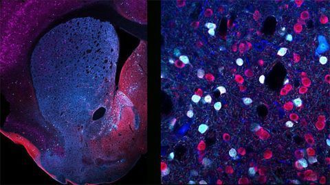 Neuronal Diversity in the Striatum