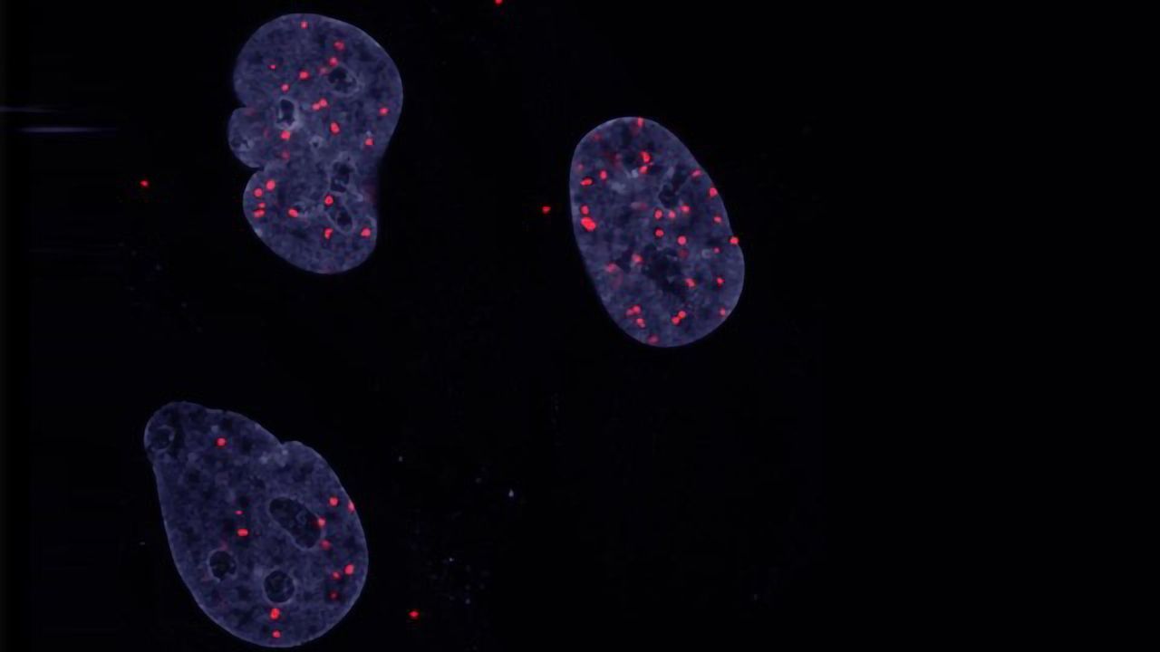 Insight Into Cancer Cells’ Lack of Contact Inhibition