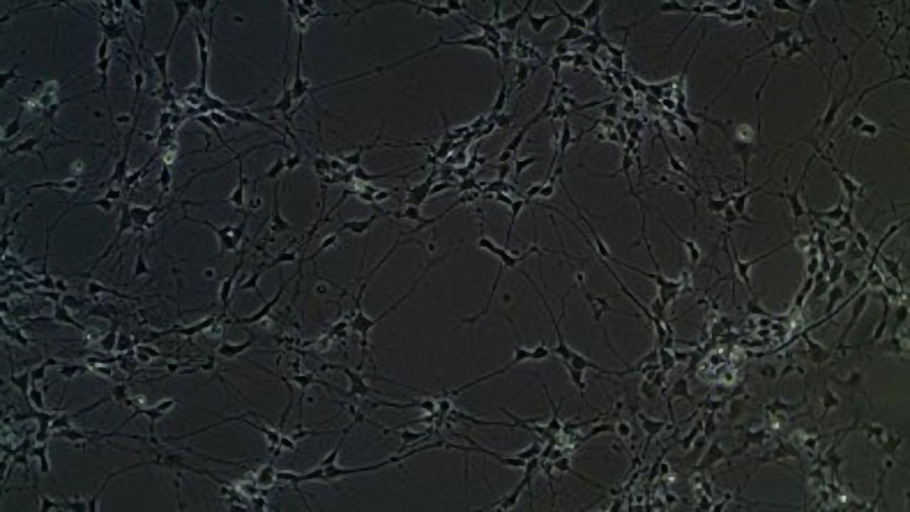 Group of Genes Have Altered Expression in Autism