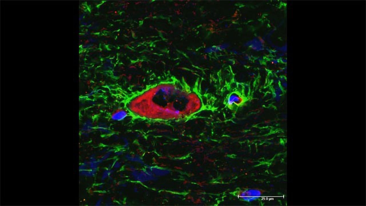 "Cell Pores" Study Points Way to Stopping Brain Injury-Related Swelling