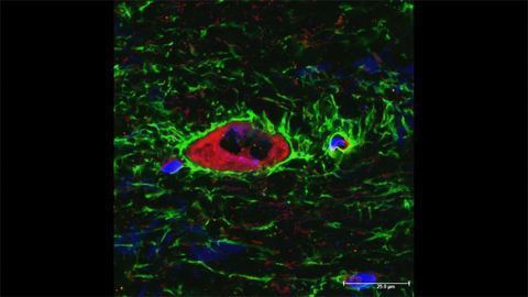 "Cell Pores" Study Points Way to Stopping Brain Injury-Related Swelling