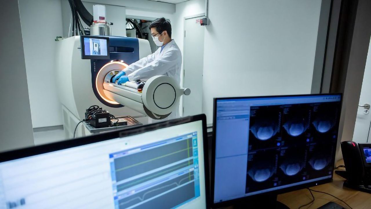 Glucose-measuring Imaging Technique May Identify the Early Stages of Alzheimer's