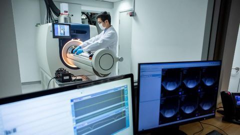 Glucose-measuring Imaging Technique May Identify the Early Stages of Alzheimer's