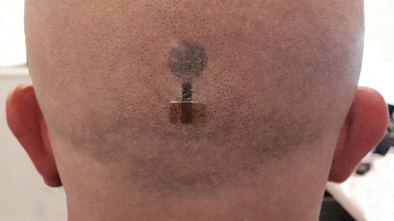 "Tattoo Electrodes" Can Now Be Used To Measure Brain Activity