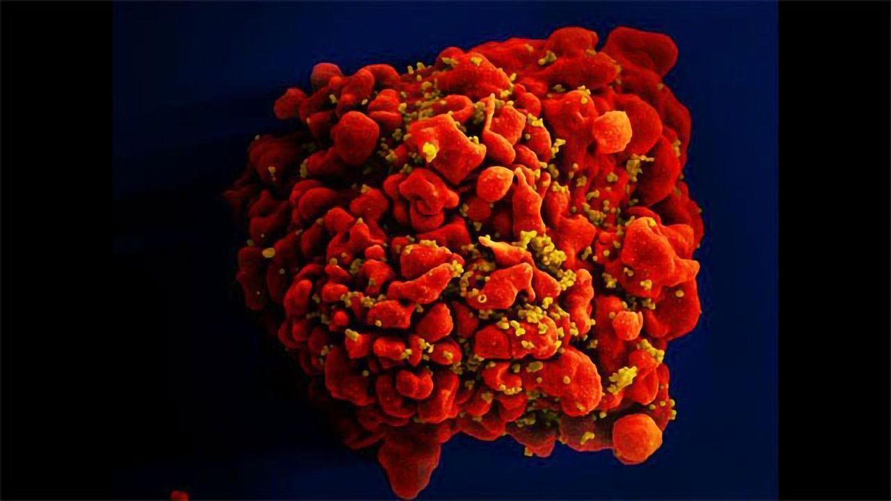 HIV-infected T Cell