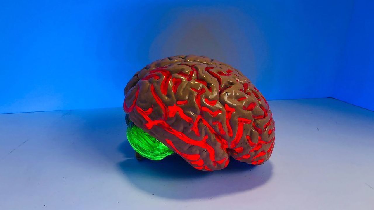 Genetic Patterns in Brain Cancer Tumors Can Predict Life Expectancy