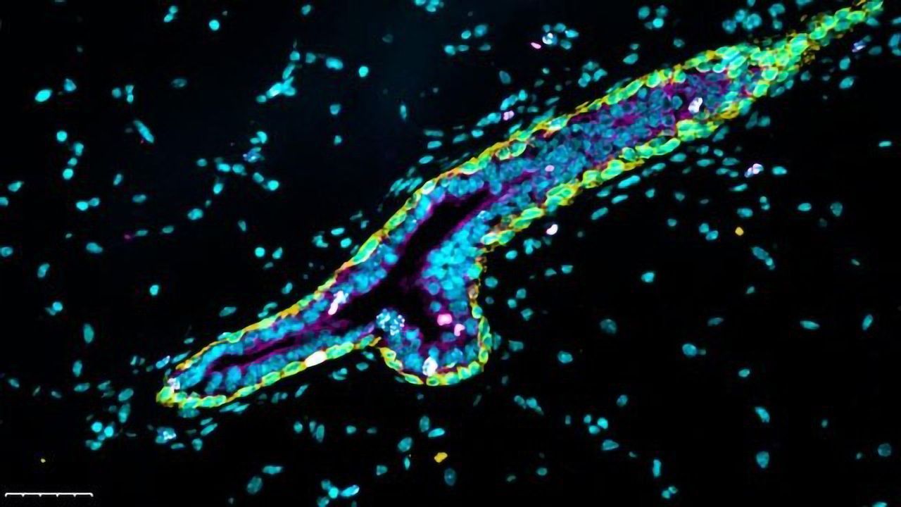 Novel Mechanism in Estrogen Receptor-positive Breast Cancer Cells Uncovered