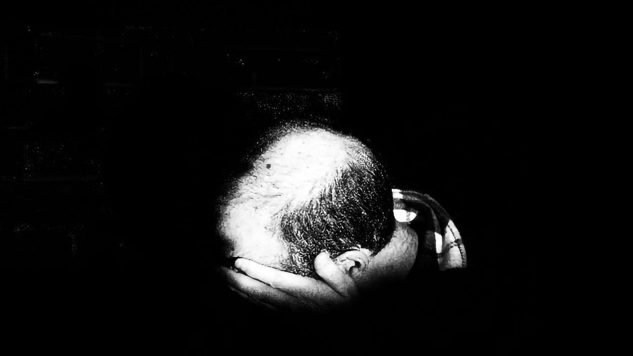 Clinical Trial Shows Topical Stem Cell Treatment Leads to Hair Regrowth in Common Type of Baldness
