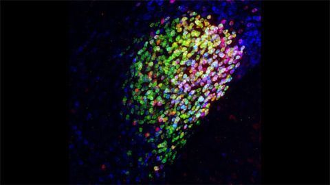 The Central Amygdala's Pain Center