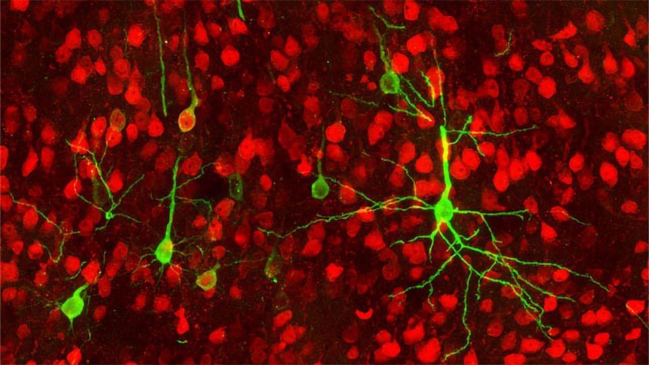 Gut-brain Connections
