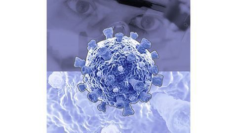 Oxford Immunotec Releases the T-SPOT® Discovery™ SARS-CoV-2 Kit