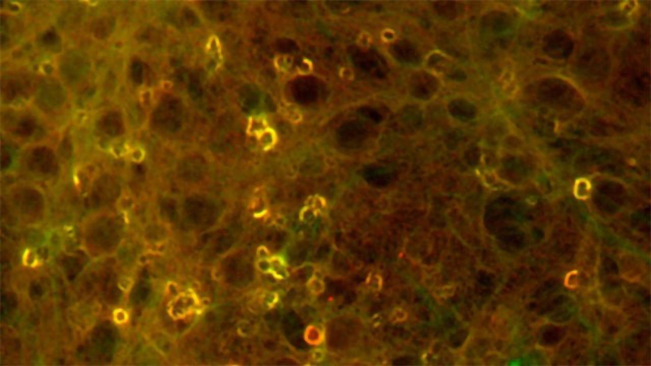 A Closer Look at the Root of Protein Misfolding