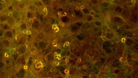 A Closer Look at the Root of Protein Misfolding