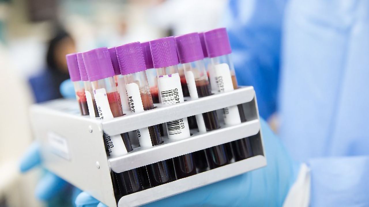 A Non-invasive Test for Early Detection of Endometrial Cancer Developed